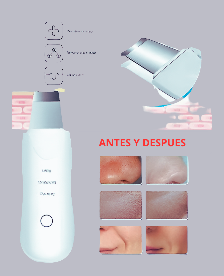 Espatula Facial Ultrasonica Exfoliante